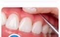 Gum Treatment