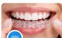 Orthodontics
